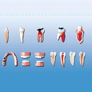 Teeth lesion series model